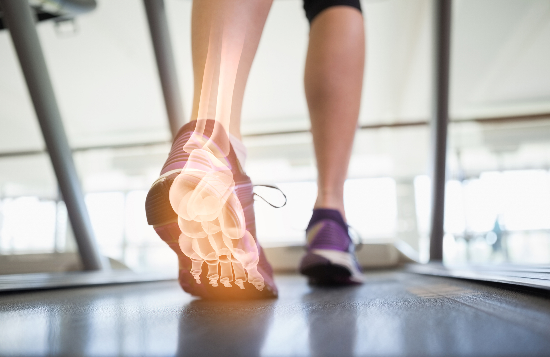 Jogging feet with x-ray view of foot bones