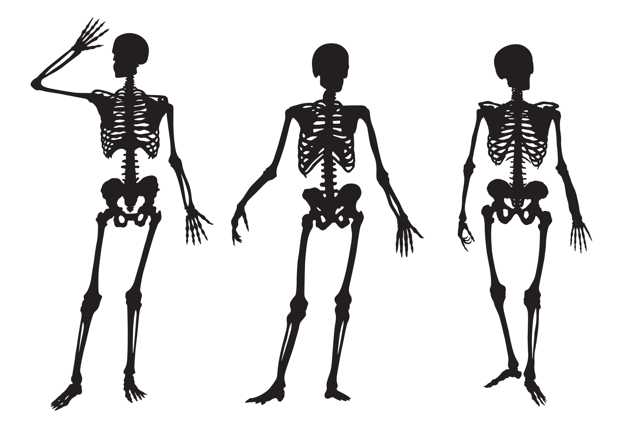 3 human skeletons
